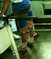 Рис. 11. Обучение стоянию в коленоупоре с открытой калиткой при помощи резиновых тяг, 
воздействующих на коленные суставы в направлении спереди-назад